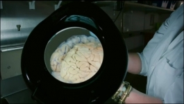 Mysteries of Mental Illness - Season 01 Episode 04